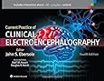electroencephalography basic principles clinical applications and related field